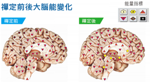 禪定10分鐘前後，呈現出大腦能量的差異極大
