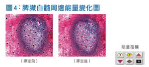脾臟白髓周邊能量變化圖