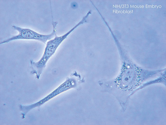 顯微鏡下培養中的NIH/3T3纖維母細胞。圖／英文維基百科的SubtleGuest (CC BY-SA3.0)