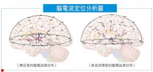 腦電波定位分析圖