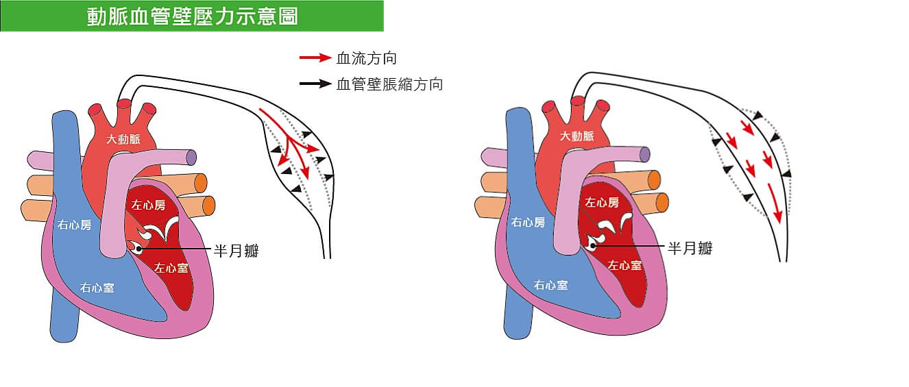 動脈血管壁壓力示意圖