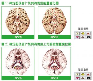 禪定前後杏仁核與海馬迴能量變化圖