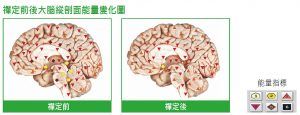 禪定前後大腦縱剖面能量變化圖