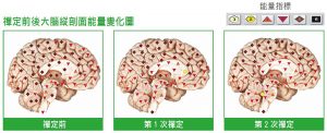 禪定前後大腦縱剖面能量變化圖