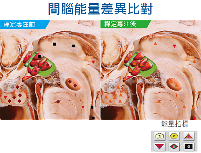 受測者在禪定專注間腦後發現,整體能量比禪定前增強了。