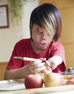 為了照顧癌母，莊雅菁必須學會用殘缺的手做事，包括削蘋果。
