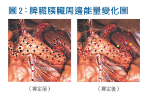 脾臟胰臟周邊能量變化圖