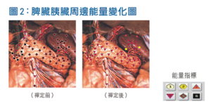脾臟胰臟周邊能量變化圖