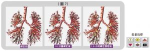 受測者比對肺部支氣管的能量變化圖