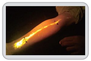 清晰經絡螢光影像