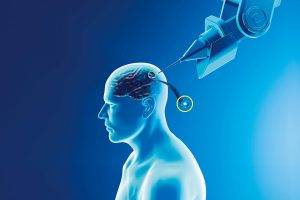 229-科技趨勢:Neuralink腦機介面